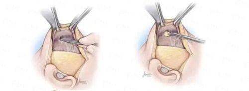 <strong>三、深度解析：张迪院长高难度鼻综合技术的核心优势</strong>