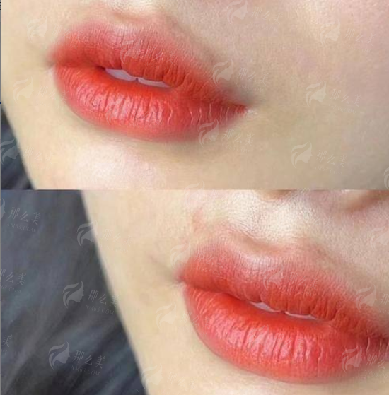 <strong>骨相重塑特色治疗方式与仪器辅助，提升精细度与安心</strong>