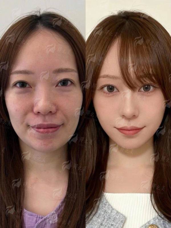 郑州她山医疗美容医院地址在哪？李永峰丰胸风格优势&价格表一览，新颜智尚小程序预约省心快速