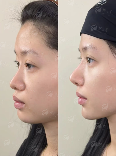 <strong>郑州她山李永峰丰胸价格区间与收费标准</strong>