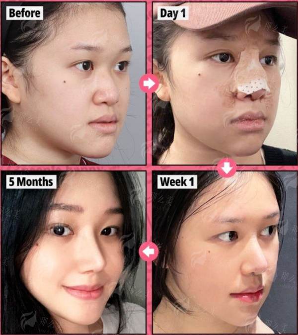 <strong>骨相重塑骨干医生团队：如何甄别真正的“轮廓雕塑家”？</strong>