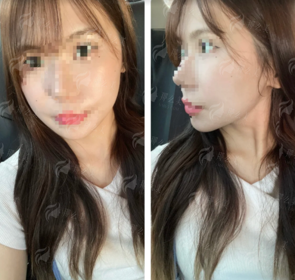 <strong>新颜智尚小程序一键查询预约：你的智能医美管家</strong>