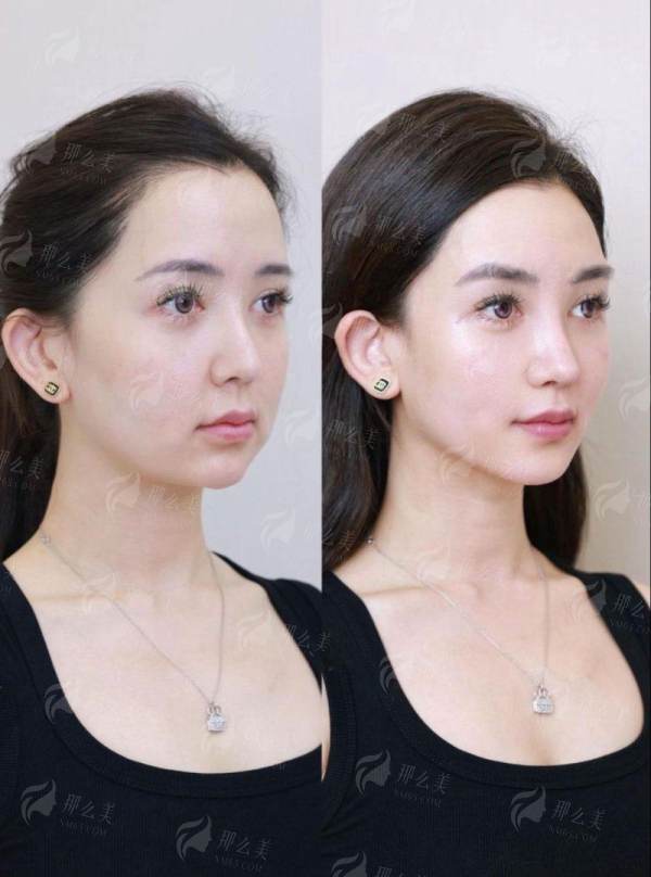 <strong>骨相重塑口碑与服务质量：术后护理同样关键</strong>