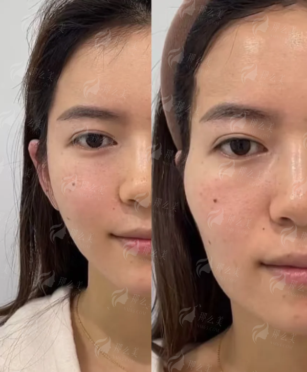 <strong>医院实力背书：珠海韩妃为高难度磨骨手术提供了什么保护？</strong>