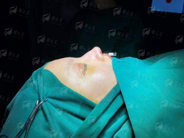 重庆浩茂医疗美容口腔门诊眼周抗衰效果如何？医生简介+案例对比-新颜智尚小程序一键预约！