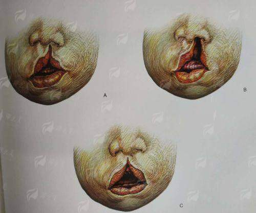 想预约重庆华美隆胸？新颜智尚小程序一键搞定，附医生信息与价格了解