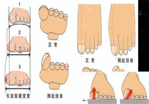 <strong>二、广州建国医院的阴唇整形医生团队实力如何？</strong>