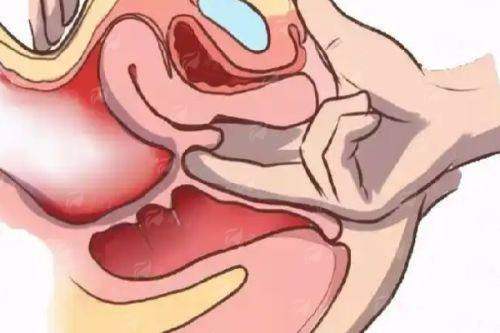 <strong>四、如何理性选择并开启重庆华美的隆胸之旅？</strong>