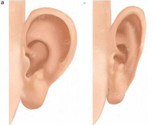 <strong>四、选择杭州艺星杨连华医生，面诊和术后要注意什么？</strong>