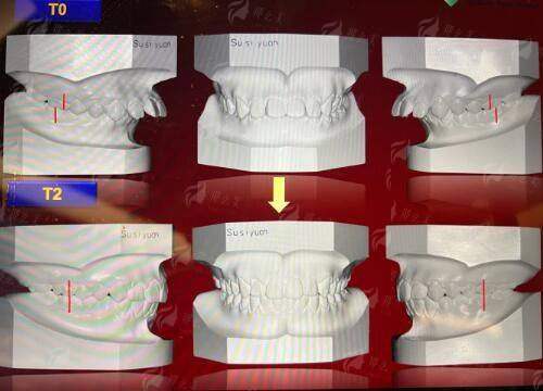 大连双眼皮手术预约指南：王香平刘志刚医生技术特色与地址&价格表速览，线上预约已开启！-24小时新颜智尚小程序预约