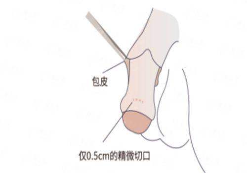 <strong>三、北京米兰柏羽的小耳畸形矫正价格与流程是怎样的？</strong>