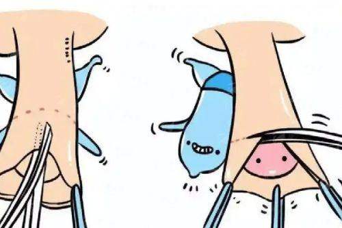 <strong>三、<strong>除了谭焰红院长，重庆还有哪些做自体软骨隆鼻的选择？</strong></strong>