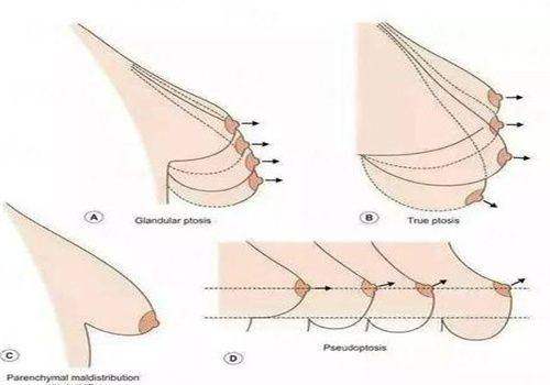 <strong>二、在杭州艺星做杨连华双眼皮，具体有哪些项目和价格？</strong>