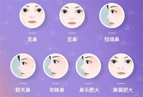 <strong>四、广州植发医院排行榜之预约方式与价格参考全攻略</strong>