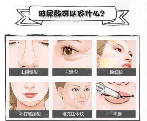 <strong>四、如何预约邵阳曹家整形医疗美容的双眼皮面诊？</strong>