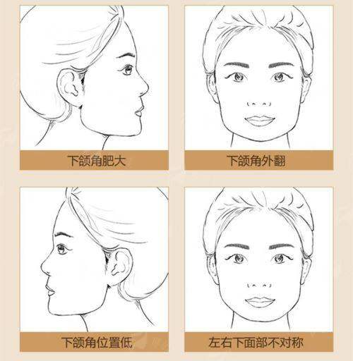 <strong>四、<strong>如何预约南京国内外医院医疗美容的脂肪填充面诊？</strong></strong>