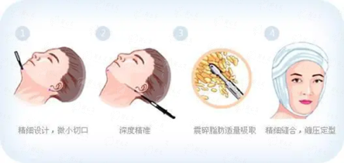 <strong>二、上海仁爱医院的双眼皮医生团队实力如何？</strong>