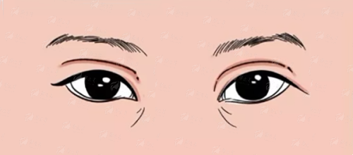 四、重庆铜雀台整形医院吸脂项目价格参考