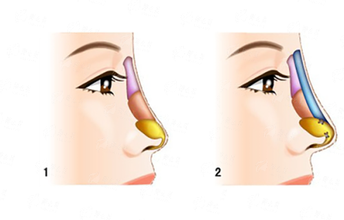 <strong>三、上海首尔丽格唐鏖医生的口碑与预约方式有哪些？</strong>