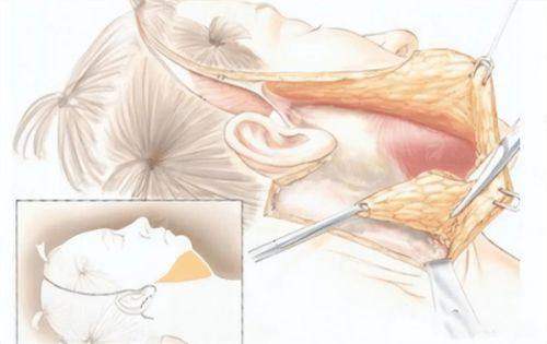 <strong>四、<strong>柳州美丽焦点吸脂如何选择与预约？</strong></strong>