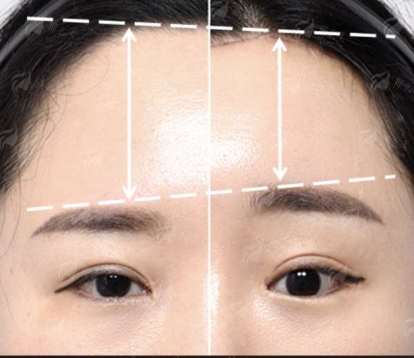 <strong>二、在重庆做腹壁整形，价格和预约方式是怎样的？</strong>