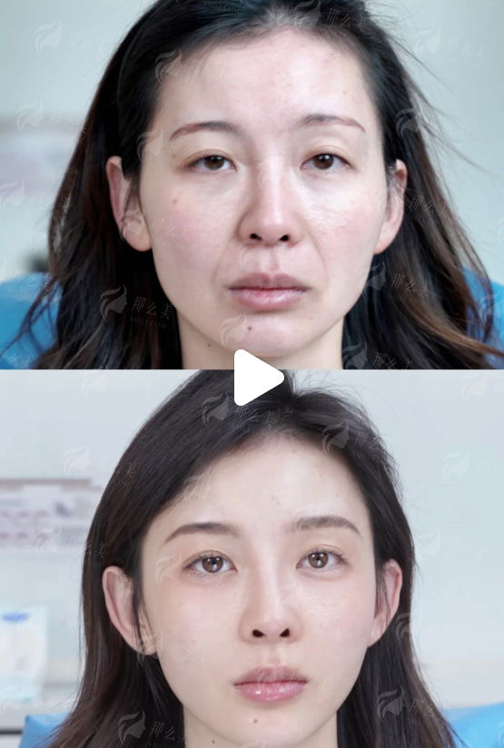 <strong>三、<strong>在洛阳华美做疤痕修复，价格和预约方式是怎样的？</strong></strong>