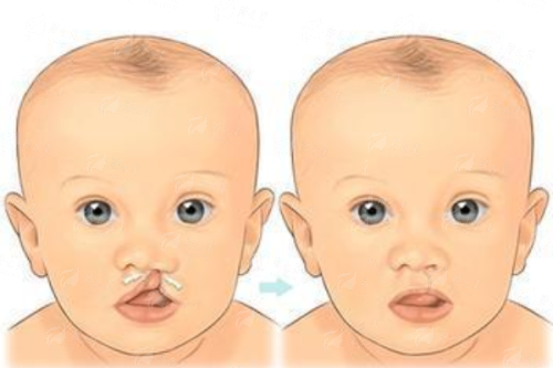 <strong>全息六维层离清奥术 vs SEER频谱智能清除术，如何选择？</strong>