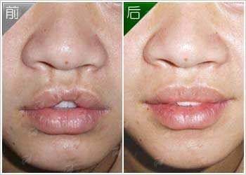 <strong>北京丰联丽格眼修复的服务与口碑怎么样？</strong>