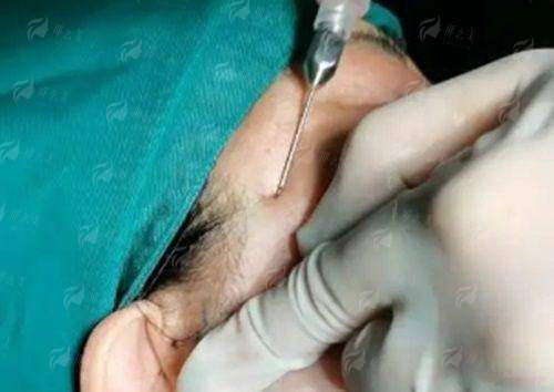 <strong>除了李高静医生，浙江湖州曙光医院还有哪些实力保护？</strong>