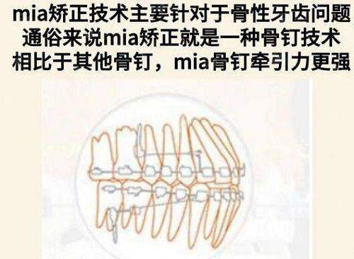 上海联合丽格范荣杰鼻整形技术好在哪？原生感审美解析与价格案例大公开，新颜智尚小程序一键预约！