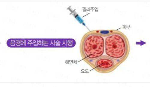 <strong>师丽丽S-ACC眼修复技术详解：它如何攻克修复难题？</strong>