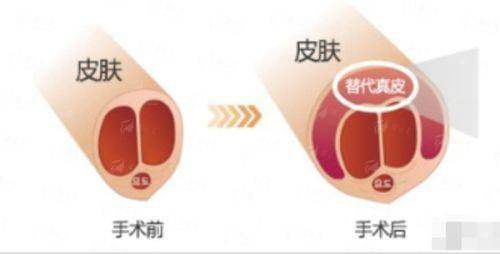 <strong>北京米兰柏羽丽都隆胸及胸部修复项目价格参考（2026年）</strong>