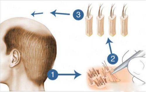 <strong>北京圣嘉新吸脂隆胸项目价格参考（2026年）</strong>