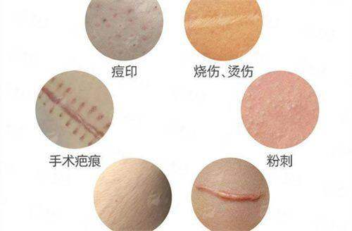 <strong>口碑与评价：求美者眼中的上海伯思立倪峰拉皮成效</strong>