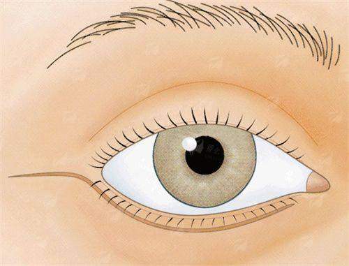 <strong>余东文主事：SEER频谱智能清除术，科技导航的“狙击手”</strong>