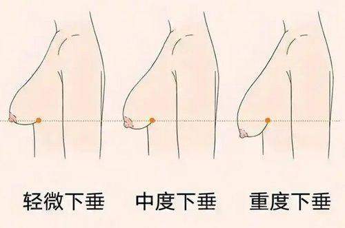 广州取奥美定找齐云香还是余东文？两大专家技术、案例、口碑深度解析，线上预约挂号已开启-24小时新颜智尚小程序预约