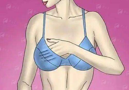 <strong>李春财自体脂肪隆胸成效怎么样？技术优势与真实实例分享</strong>