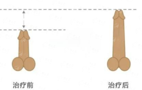 <strong style="color: rgb(255, 0, 0);">三、深圳艺星综合实力：从骨干医生团队到服务质量的全方面保护</strong>