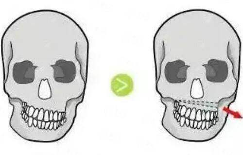 <strong>如何预约广州海峡谭新东主事面诊？</strong>