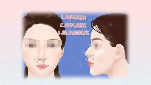 <strong>广州男性增粗延长项目价格区间与收费标准透明解读</strong>