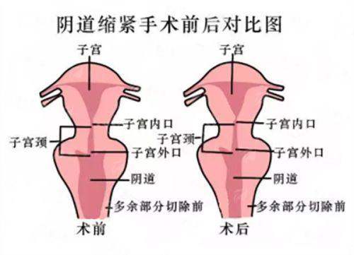 <strong>2026年黄寅守拉皮价格表汇总（参考）</strong>