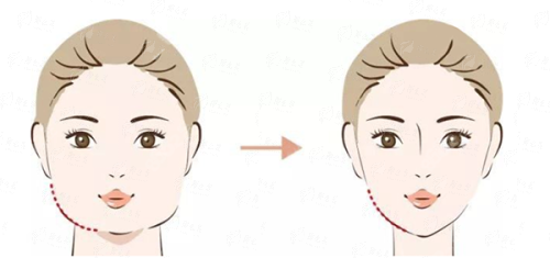 想了解武汉艺星吸脂真实效果？看这里！地址&特色项目&案例大公开，新颜智尚一键查询超方便