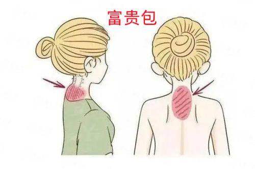 <strong>“精细弧线设计”如何实现？揭秘吴国平医生的面部美学理念</strong>