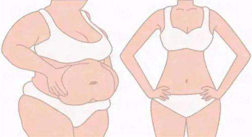 <strong>腰腹环吸价格与技术全解析：圣嘉新如何做到“吸得平、修复快”？</strong>