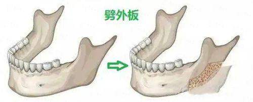 <strong>济南隆胸价格区间与收费标准解读（2026年参考）</strong>