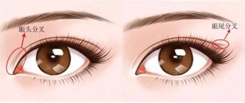 熙朵植发李会民院长艺术植发怎么样？高难度技术点拆解+机构地址&价格表，新颜智尚小程序一键预约！