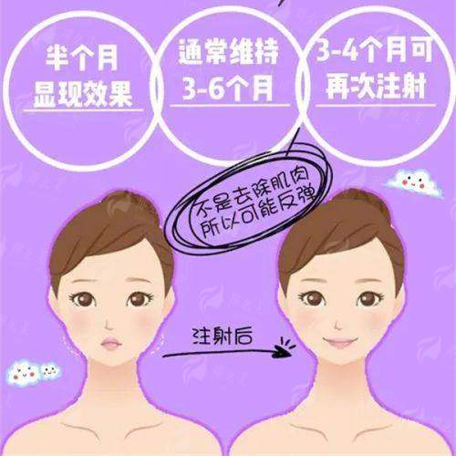 <strong>如何选择？倪峰擅长中下面部提升、大拉皮与微拉美的区别解析</strong>