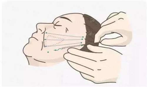 <strong>不剃发植发价格与方案解析：你的“隐形”变得更美投资</strong>