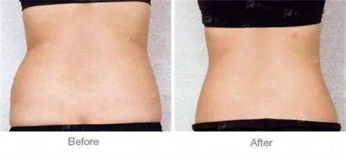 <strong>核心解答：武汉光泽皇后整形预约方式一文讲清楚</strong>