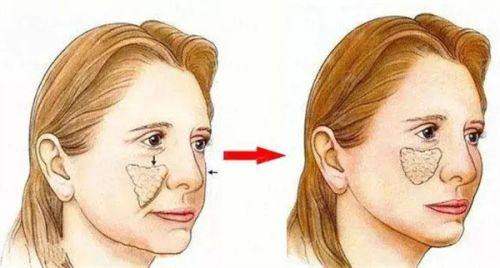 <strong>真实口碑揭秘：武汉光泽皇后整形的患者评价如何？</strong>